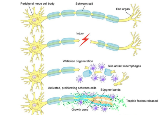 Peripheral Nerve Palsy